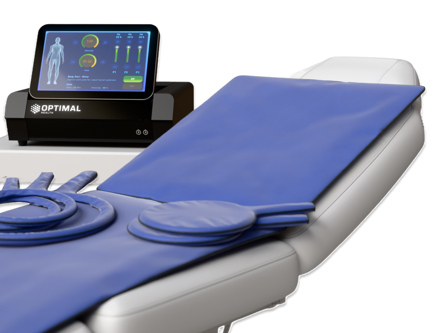 <strong>Unmatched </strong>Features for